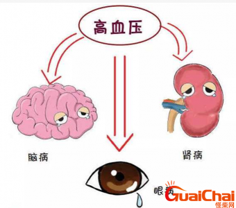 ​血压高的原因有哪些？血压高是怎么引起的？